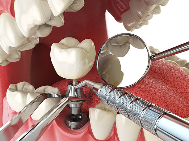 Best Walk-In Emergency Dental Services in Canyon, TX